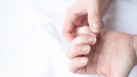 Waarom vergelen nagels?